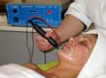 diofrecuencia Indiba facial